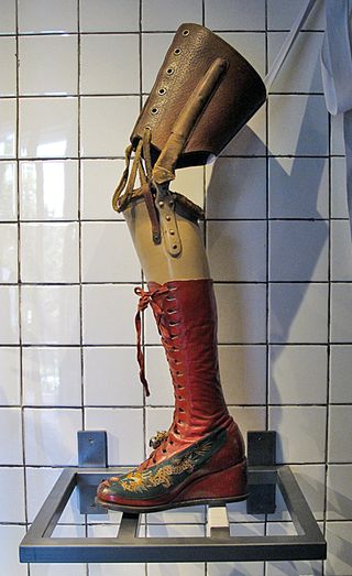 Frida Prosthesis Frida Prosthesis