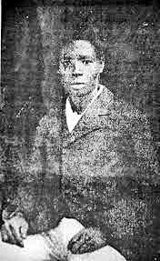 Edmond Albius 2 Edmond Albius 2