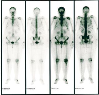 Cristina de Puro Hueso